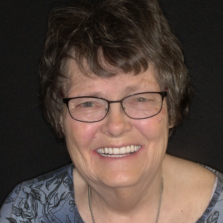 Implant Dentures - Featured